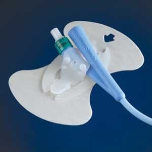 EEFCS200XTEA - Foley Anchor Urinary Catheter Securement Device