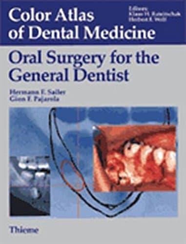 Oral Surgery for the General Dentist (Color atlas of dental medicine)
