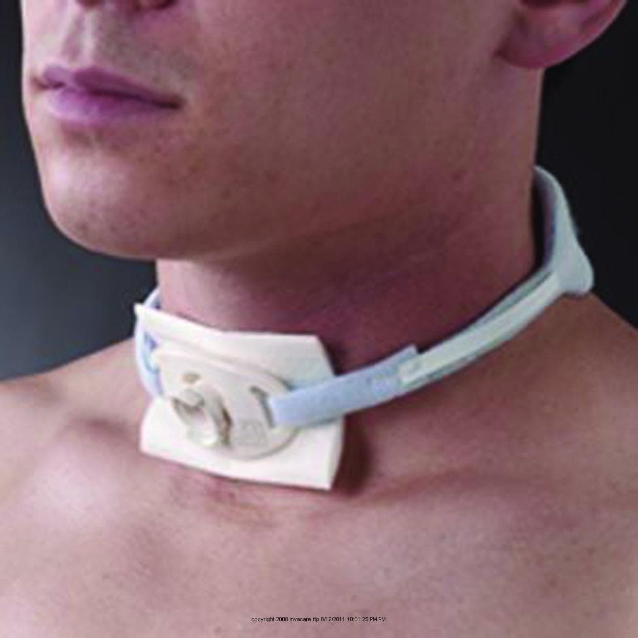 Foam Trach Collar/Tie-Size: Adult Large: 13" - 24" - UOM = Box of 12