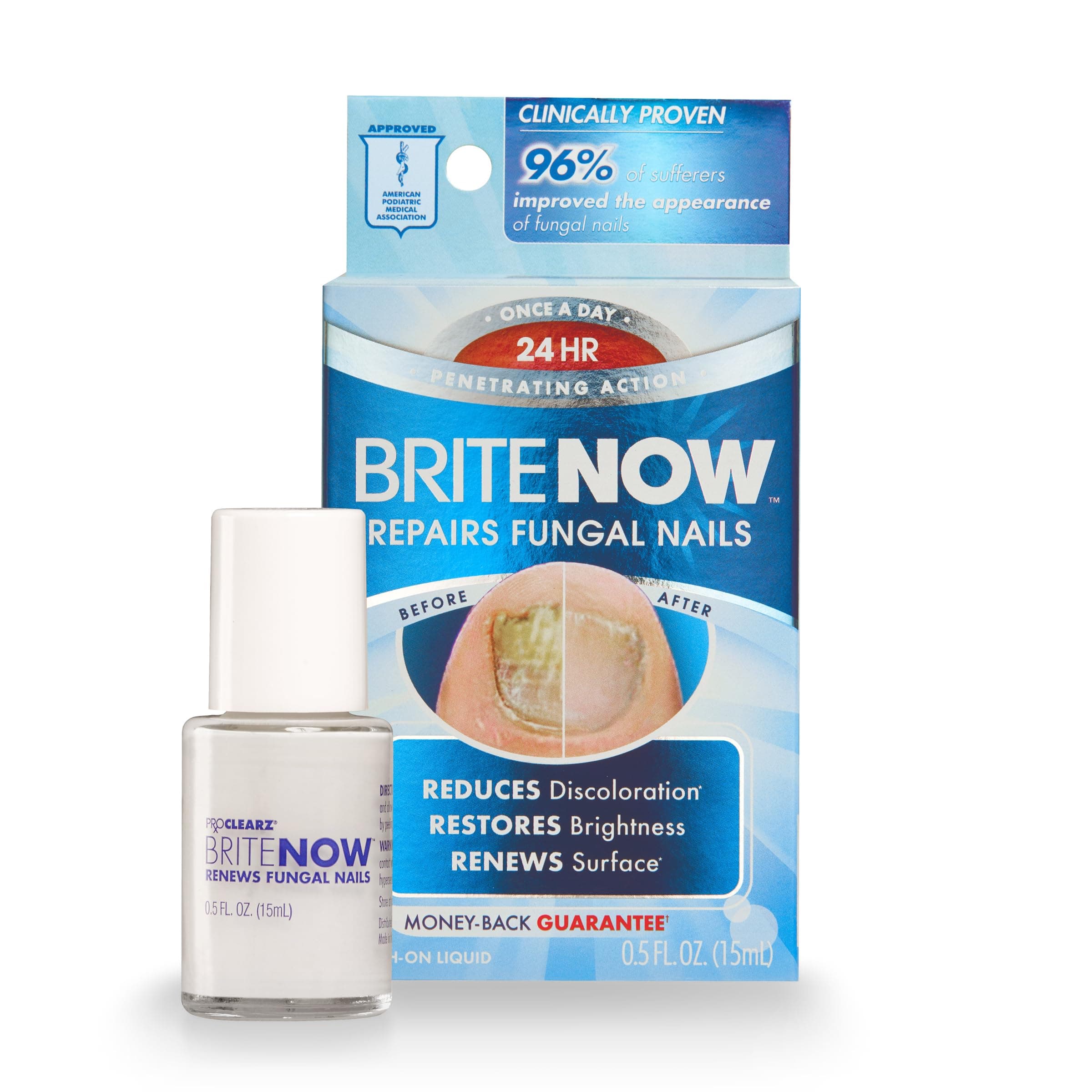 Brite Now Nail Treatment, Restores The Appearance Of Damaged & Discolored Nails, Peel-Away Technology, Brightening & Smoothing Nail Repair, 0.5 Ounce