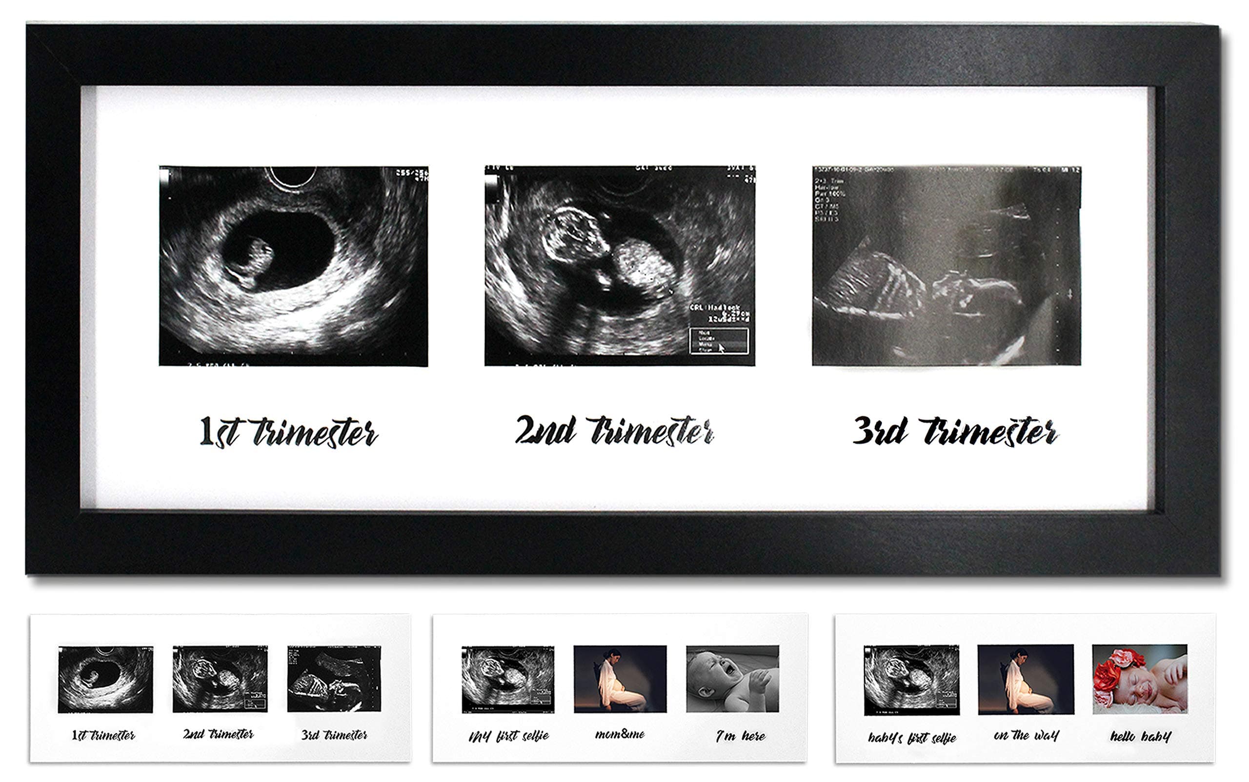Triple Sonogram Pregnancy Frame – Baby Ultrasound Picture Frame with Story for Expecting Parents, Baby Shower Frame, Baby Grow Through All Three Trimesters Frame, Nursery Decor, Black