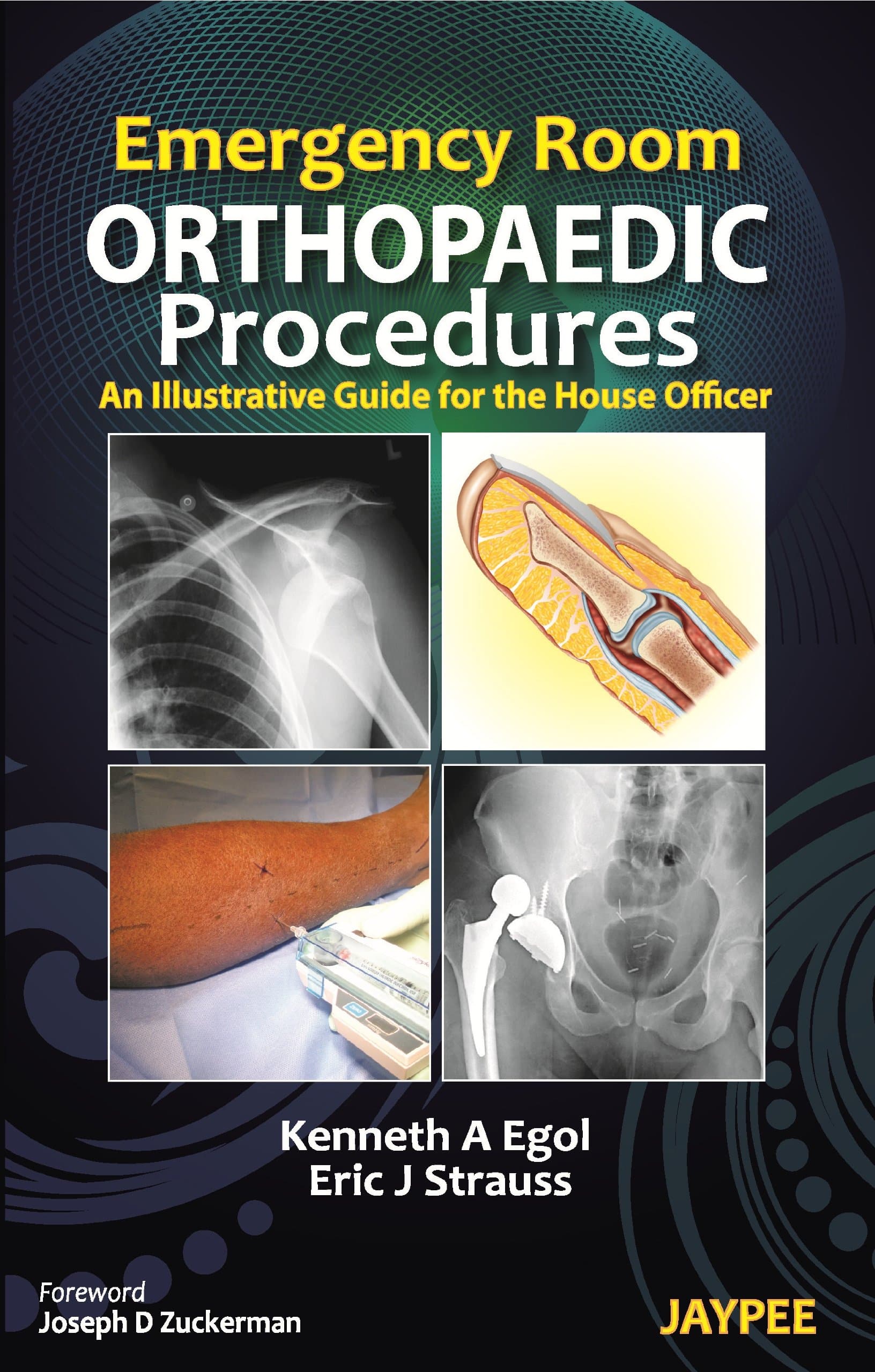Emergency Room Orthopaedic Procedures: An Illustrative Guide for the House Officer Paperback – 31 Mar. 2012