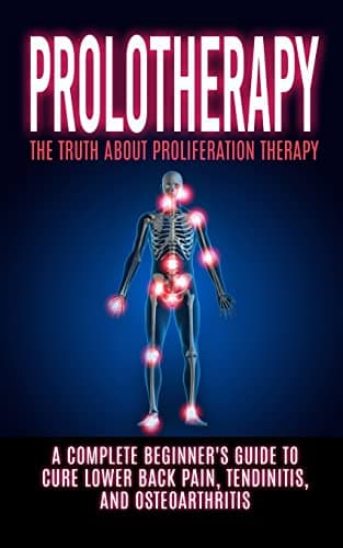 Prolotherapy: The Truth About Proliferation Therapy: A Complete Beginner's Guide to Cure Lower Back Pain, Tendinitis, And Osteoarthritis