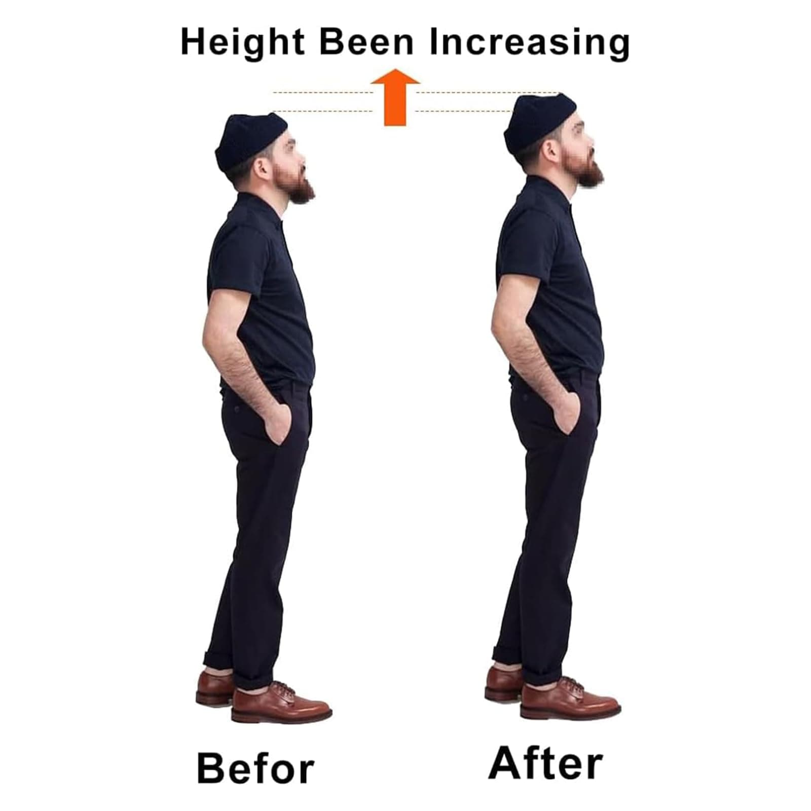 Correct-Position Heel Lift Inserts, Thick Heel Cushioning Height Increase Insoles Heel Cup Shoe Heel Inserts for Heel Spurs, Heel Pain Plantar Fasciitis Achilles Tendonitis (Beige, 1" Height)