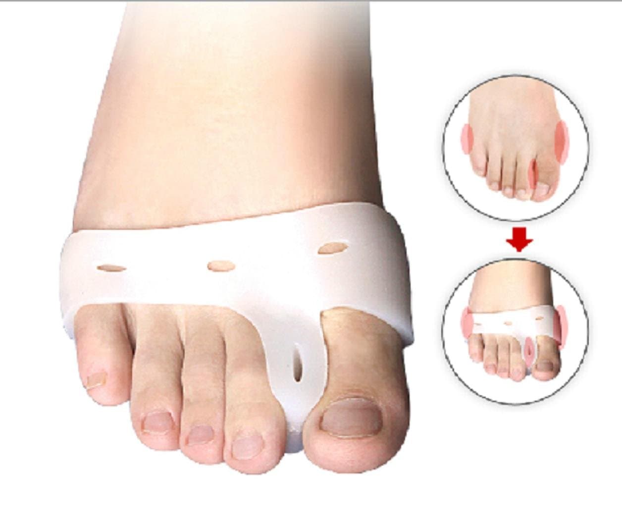 ViviST Forefoot Matress Toe Spacer Hallux Valgus Bunion Corrector Health Care