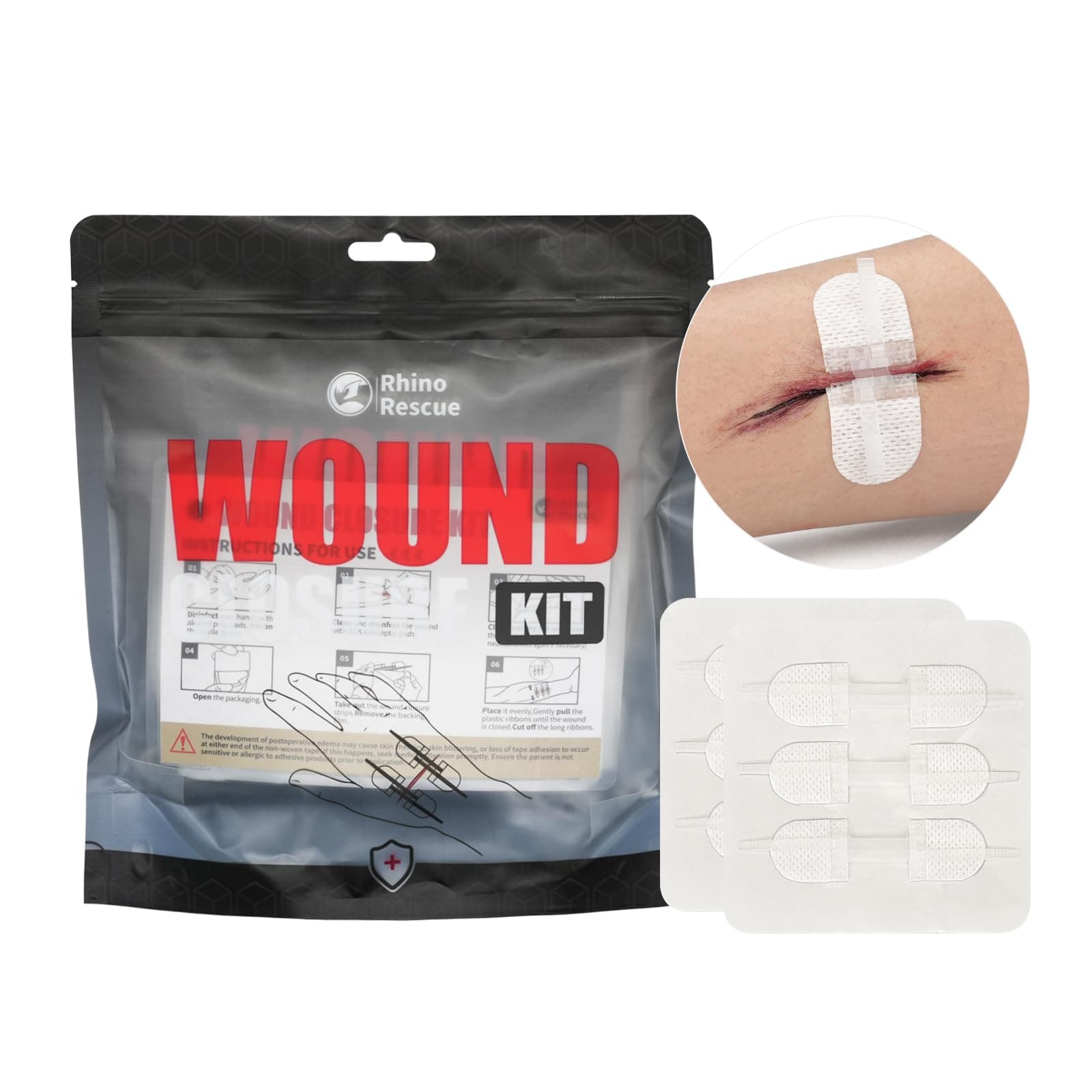 RHINO RESCUE Zip Stitch 6pcs with Wound Dresssings, Closure Strips Without Suture, Zipstitch Laceration Kit for Cut Care, Adhesive Bandages