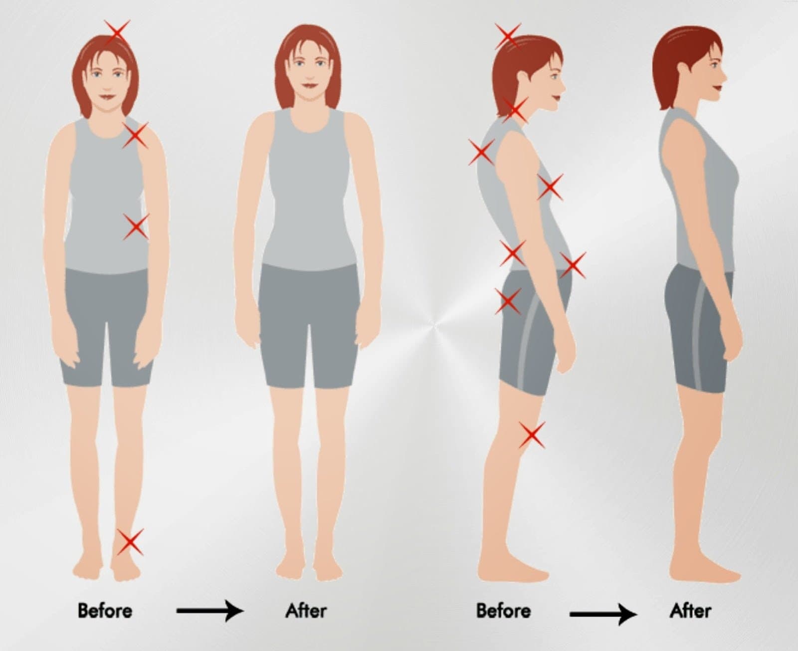 Snogg Posture & Spine Corrector for Children, Teenagers & Young Adults