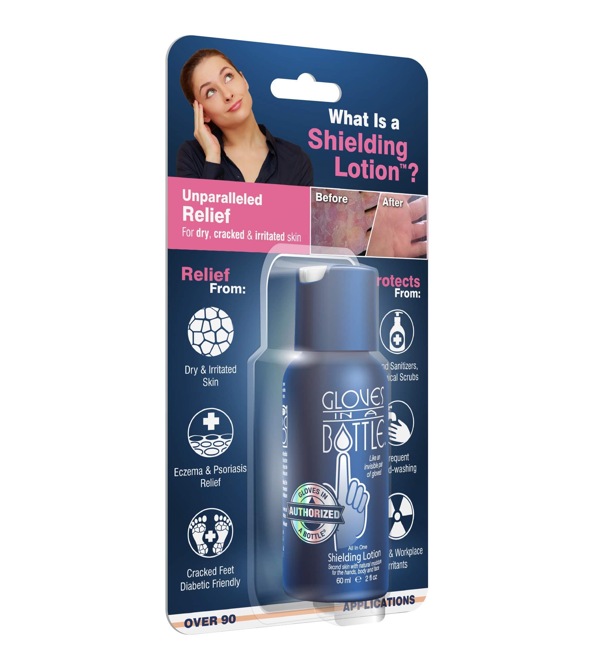 Shielding Lotion 2 oz Blister - Unparalleled relief for dry, cracked & irritated skin - For hands & body (Pack May Vary)