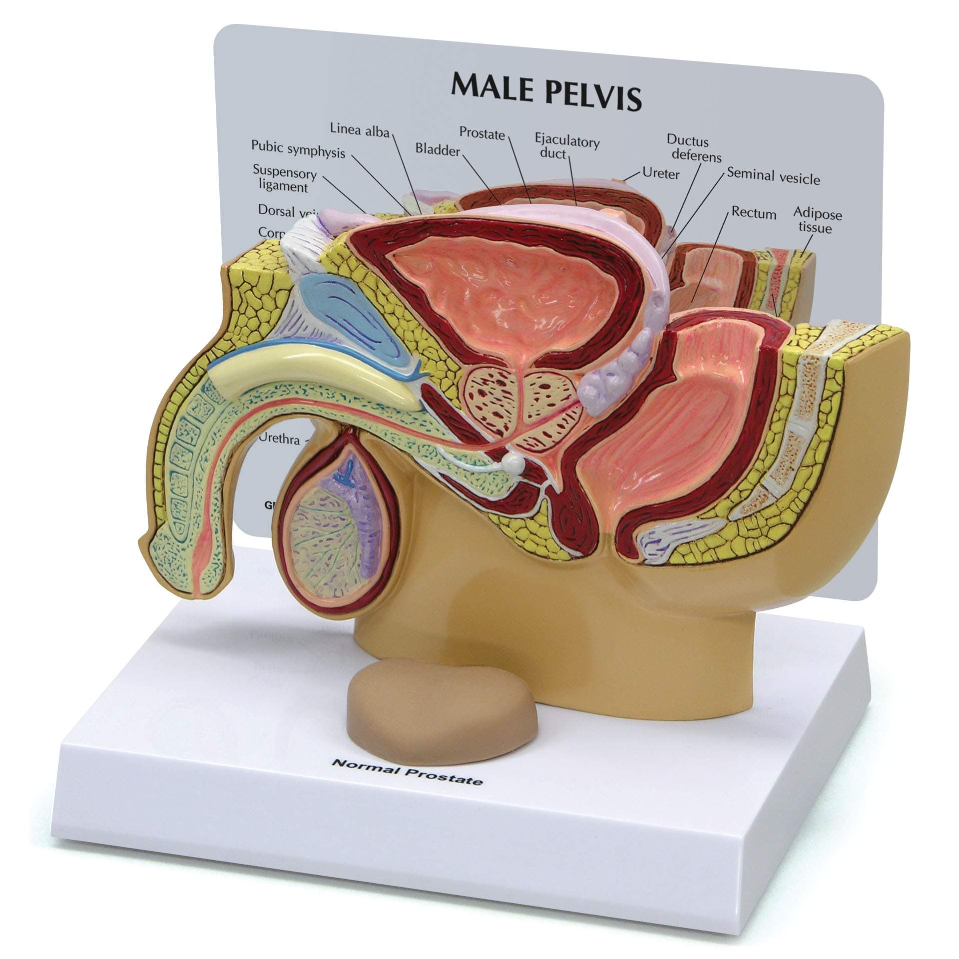 GPI Anatomicals - Male Pelvis with Prostate Model, Replica for Human Anatomy and Physiology Education, Anatomy Model for Doctor's Offices and Classrooms, Medical Learning Resources